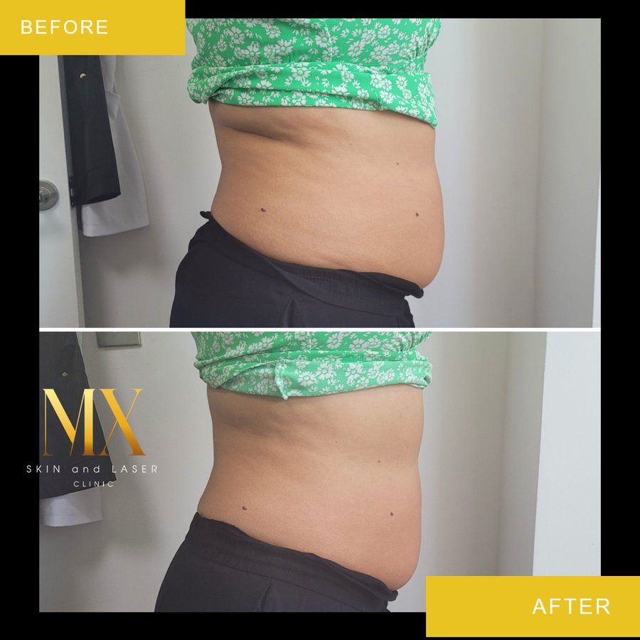 MX Skin and Laser Clinic - MX Skin and Laser Clinic