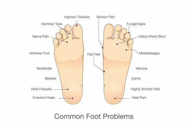 My Foot Doctor - My Foot Doctor