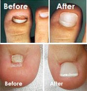 My Foot Doctor - My Foot Doctor