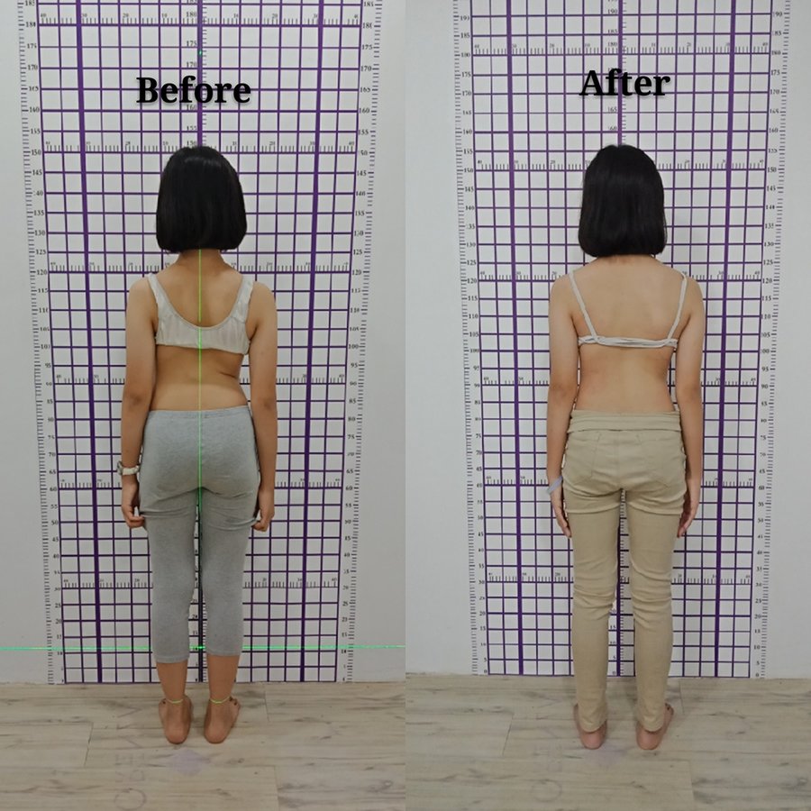 Myscoli Physio - Myscoli Physio