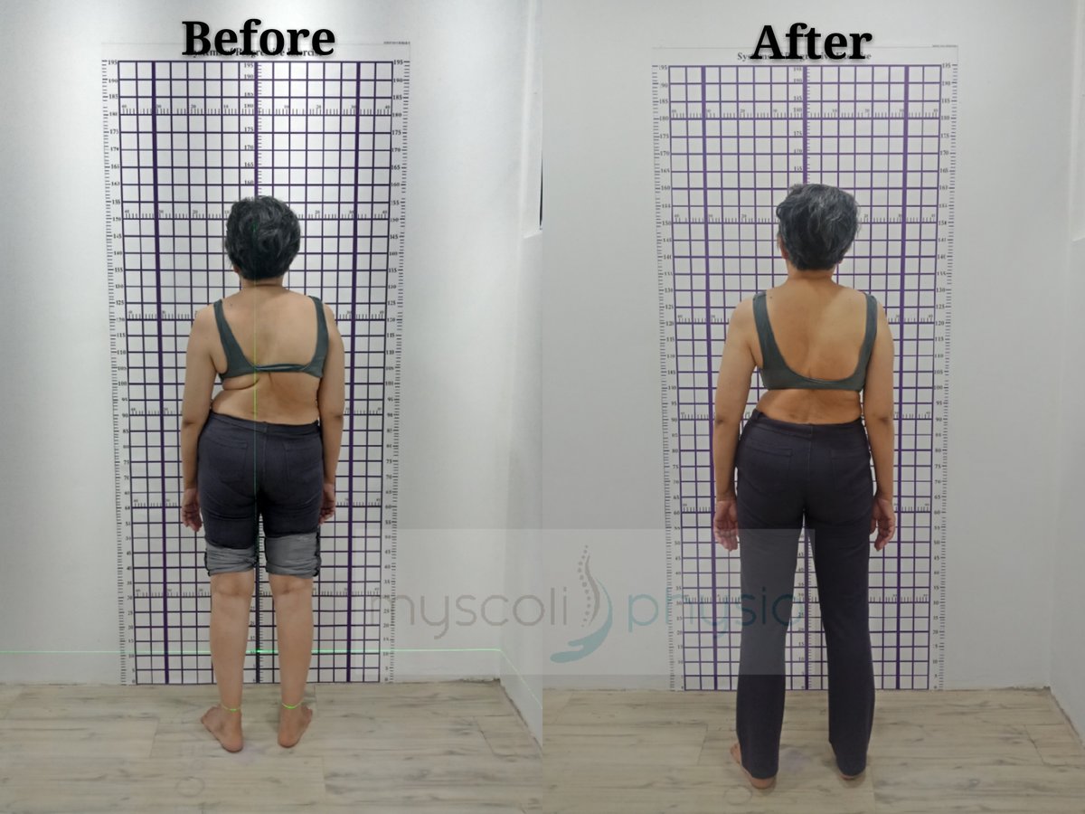 Myscoli Physio - Myscoli Physio