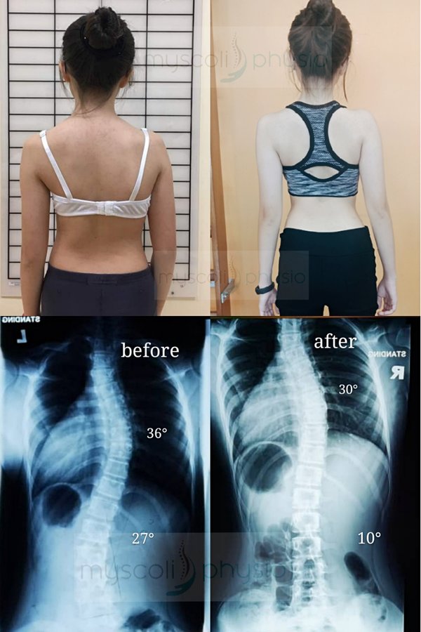 Myscoli Physio - Myscoli Physio