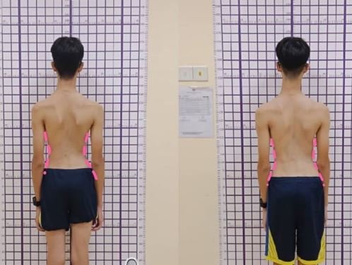 Myscoli Physio - Myscoli Physio