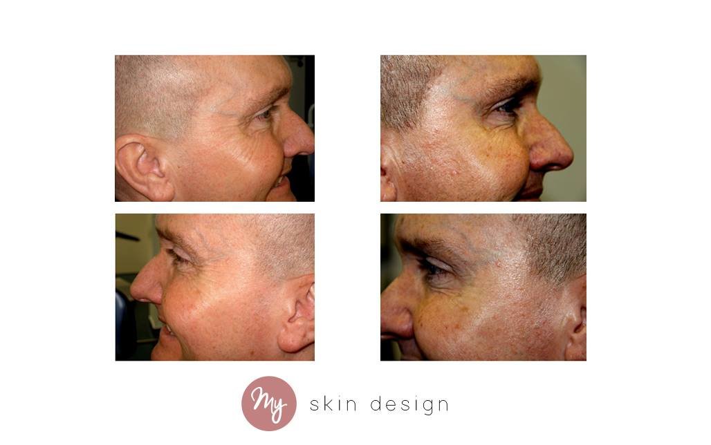 myskindesign - Wilmslow - myskindesign - Wilmslow
