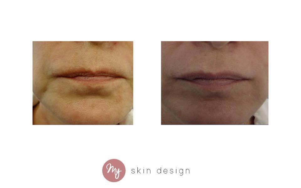 myskindesign - Wilmslow - myskindesign - Wilmslow