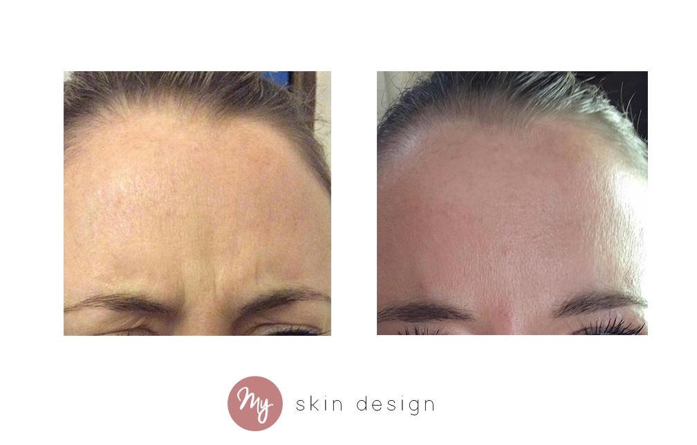 myskindesign - Wilmslow - myskindesign - Wilmslow