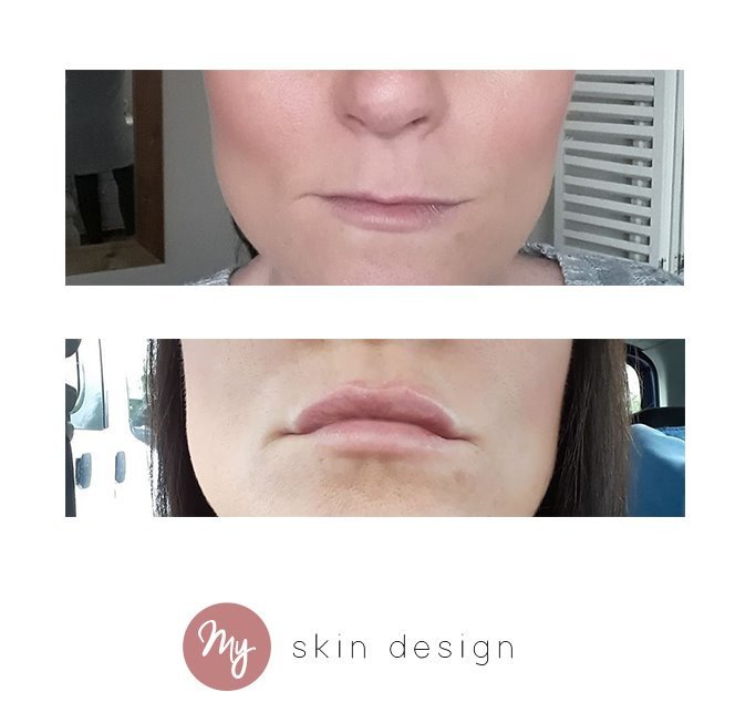 myskindesign - Wilmslow - myskindesign - Wilmslow