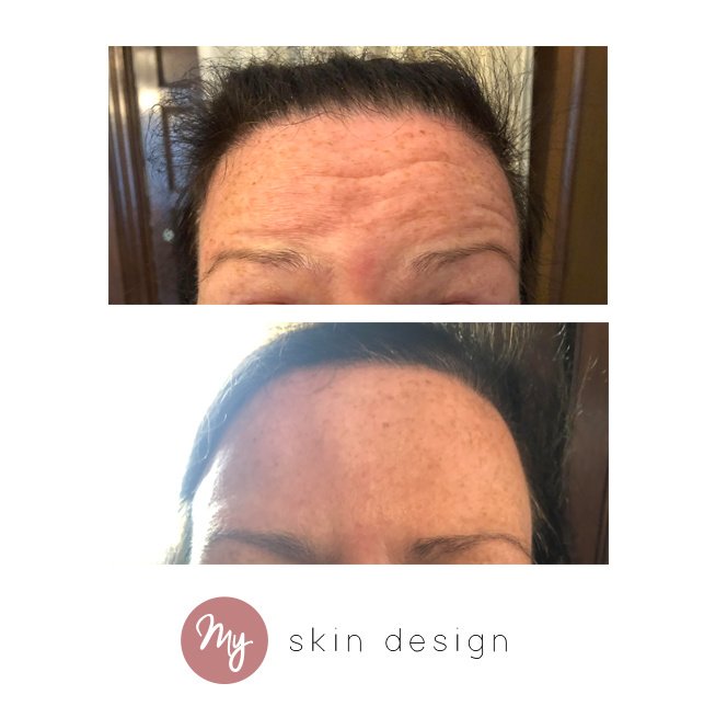 myskindesign - Wilmslow - myskindesign - Wilmslow