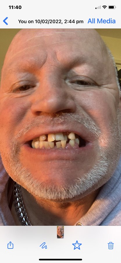 نانو الأسنان - Nano Dental