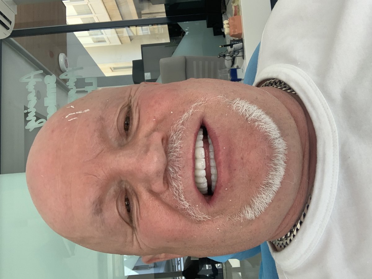 نانو الأسنان - Nano Dental