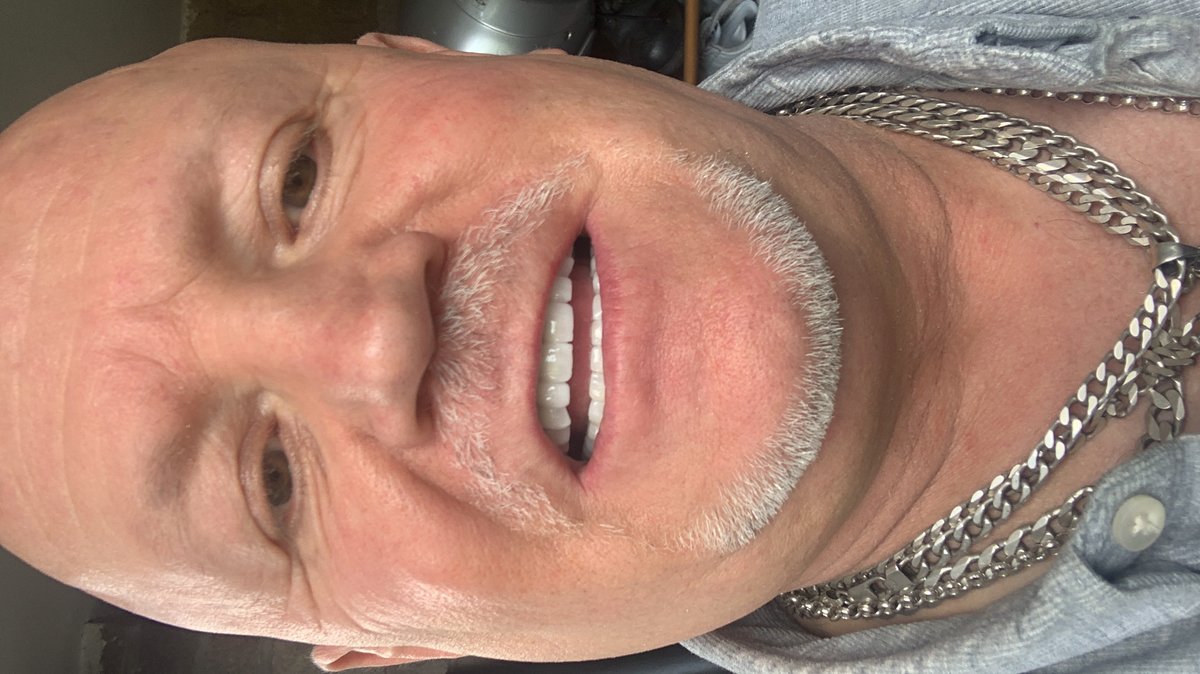 نانو الأسنان - Nano Dental