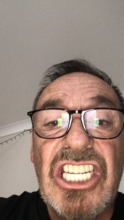 نانو الأسنان - Nano Dental