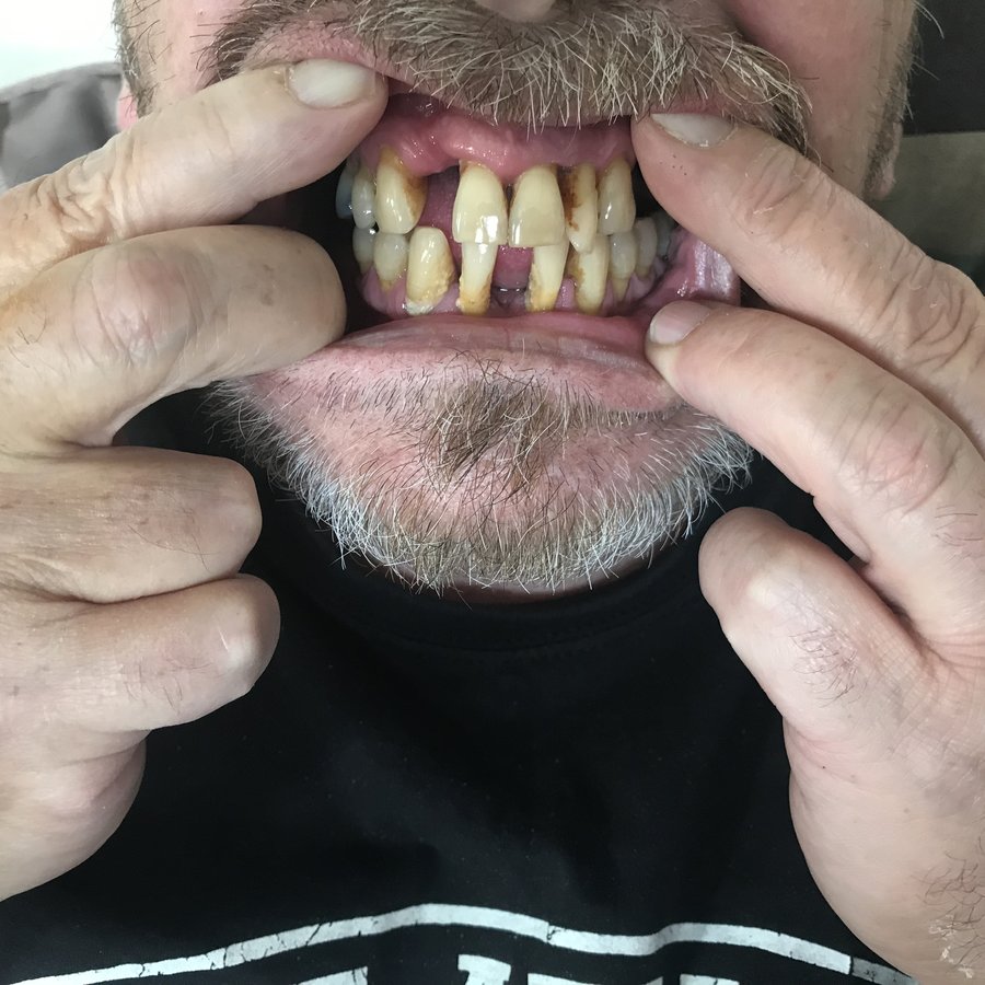 نانو الأسنان - Nano Dental