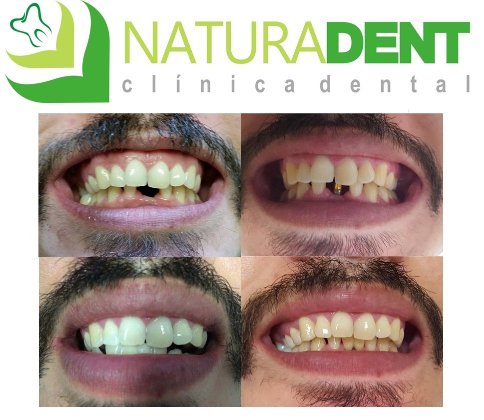Natura dent - Natura dent