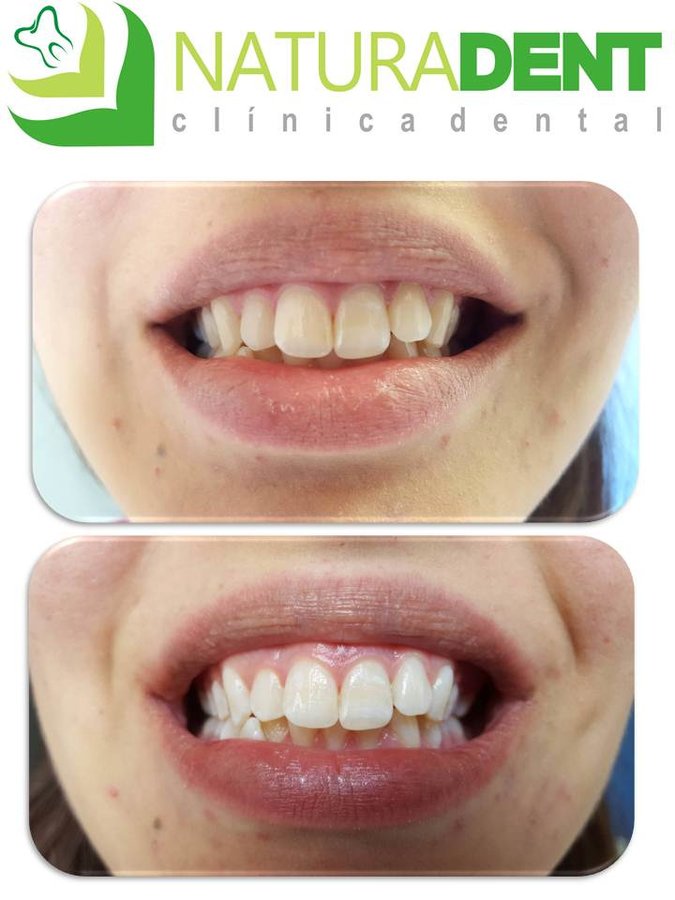 Natura dent - Natura dent