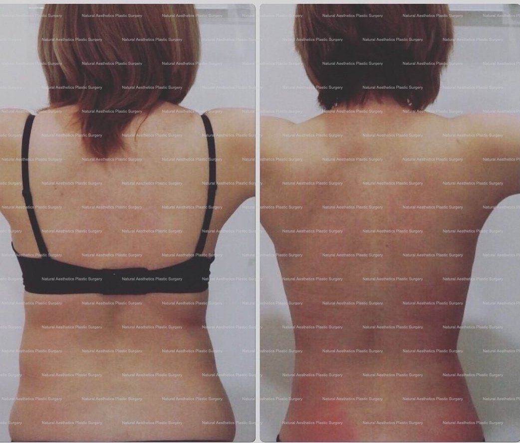 Natural Asthetics Plastic Surgery - Natural Asthetics Plastic Surgery
