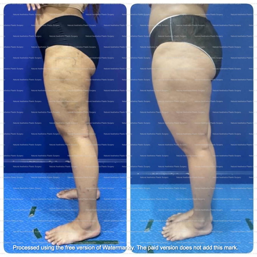 Natural Asthetics Plastic Surgery - Natural Asthetics Plastic Surgery