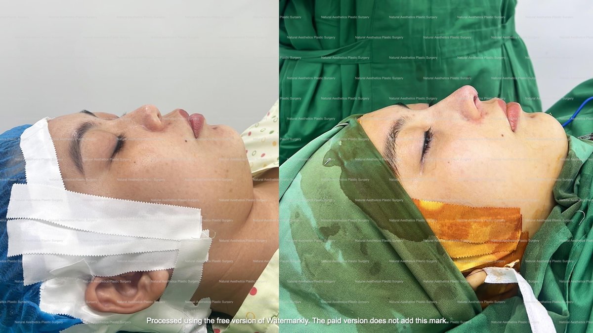 Natural Asthetics Plastic Surgery - Natural Asthetics Plastic Surgery