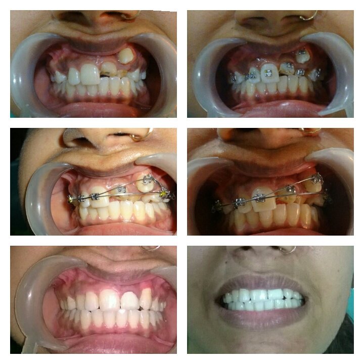 Navjyoti Dental Clinic & Implant Centre - Navjyoti Dental Clinic & Implant Centre