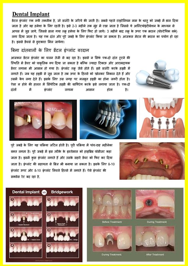 Navjyoti Dental Clinic & Implant Centre - Navjyoti Dental Clinic & Implant Centre