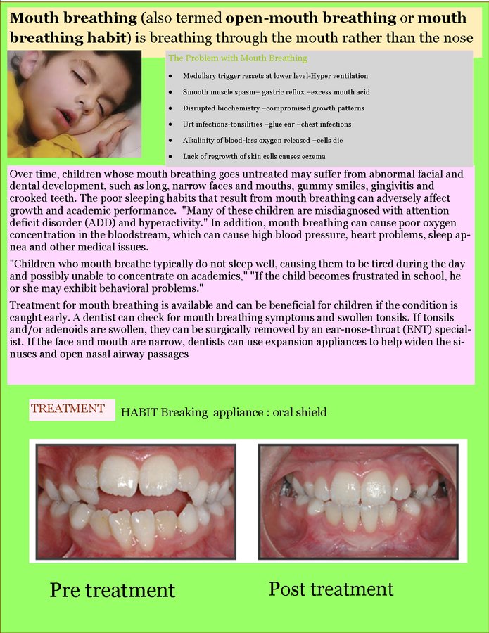 Navjyoti Dental Clinic & Implant Centre - Navjyoti Dental Clinic & Implant Centre