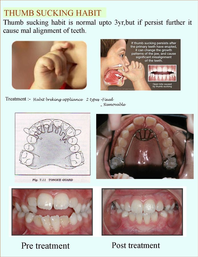 Navjyoti Dental Clinic & Implant Centre - Navjyoti Dental Clinic & Implant Centre
