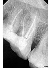 Nechupadam Dental Clinic - Nechupadam Dental Clinic