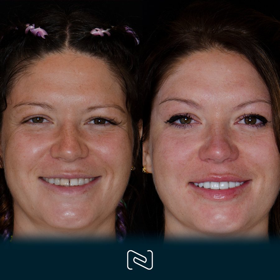 Neo Dental Cancun - Neo Dental Cancun