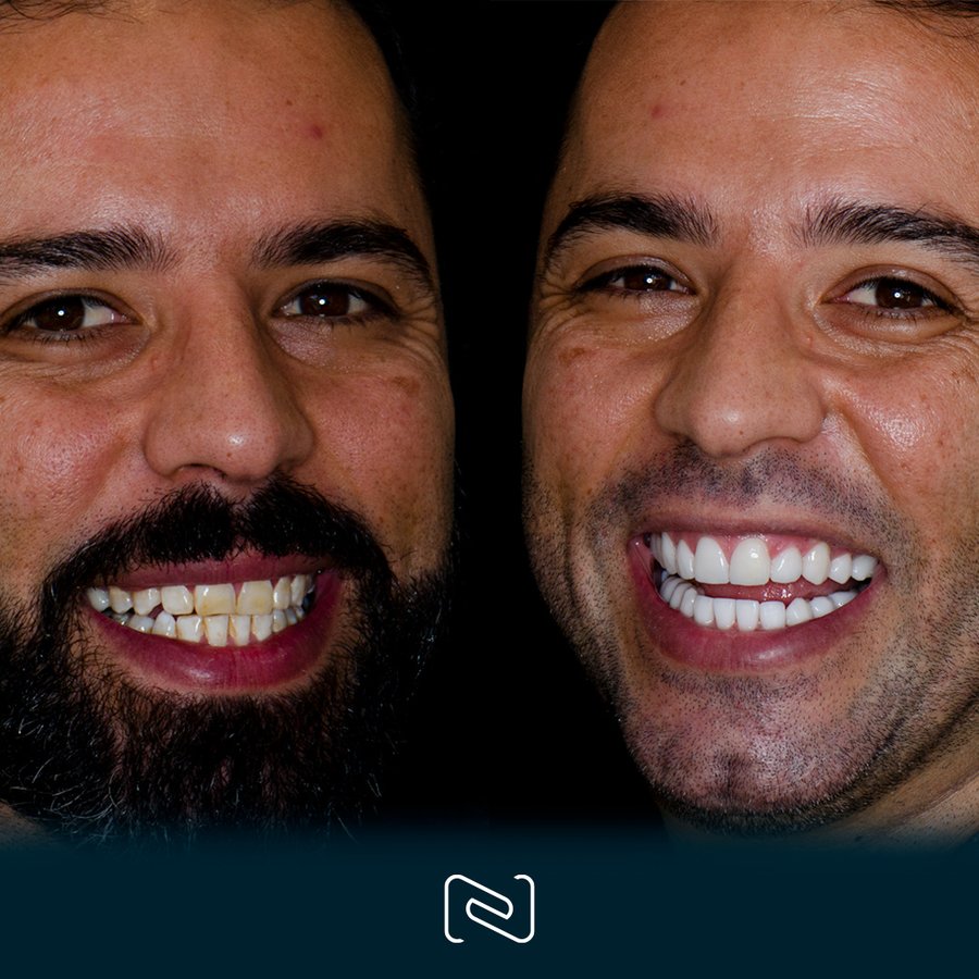 Neo Dental Cancun - Neo Dental Cancun