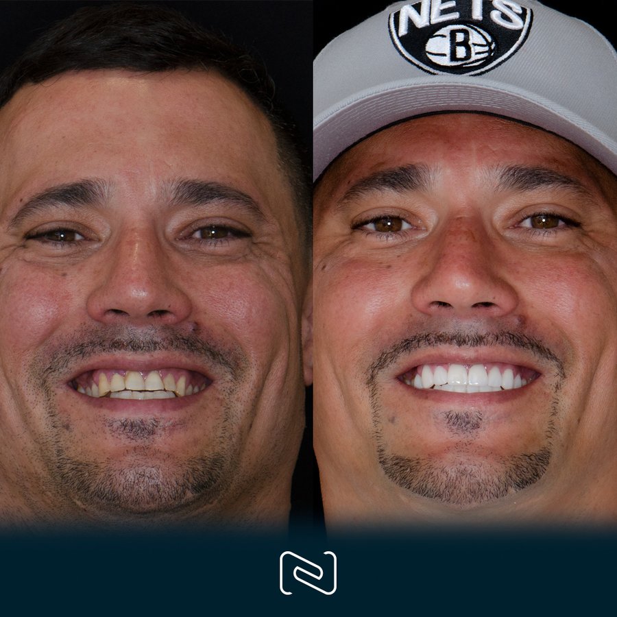 Neo Dental Cancun - Neo Dental Cancun