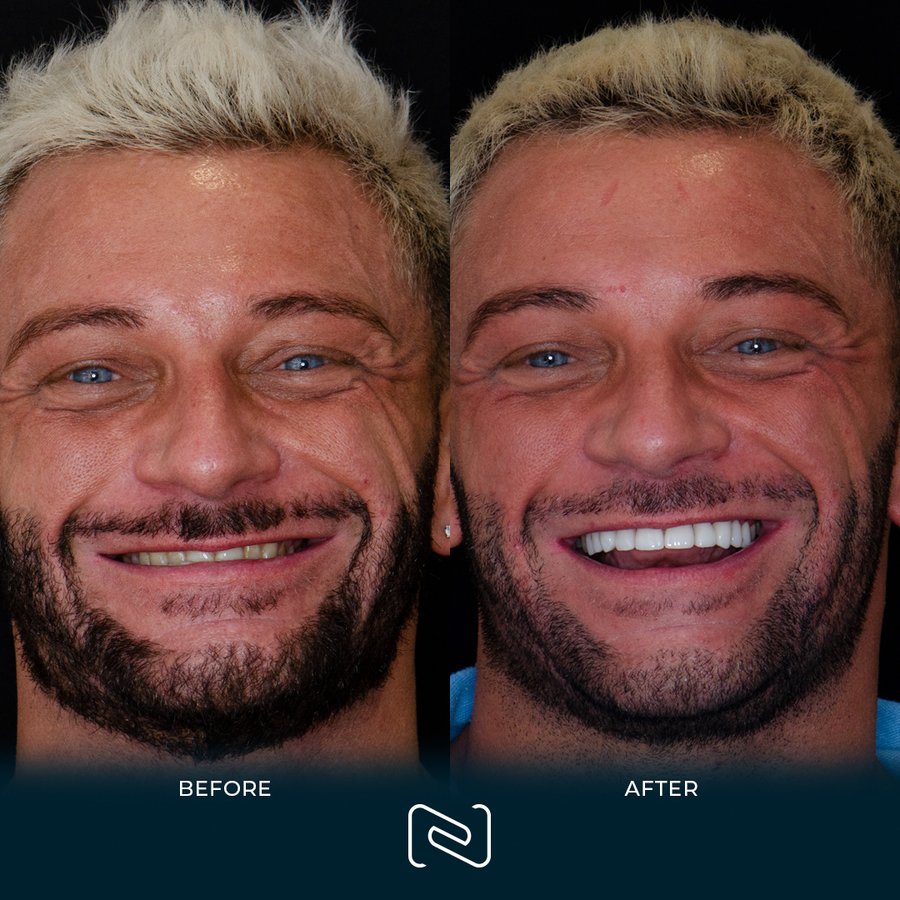 Neo Dental Cancun - Neo Dental Cancun