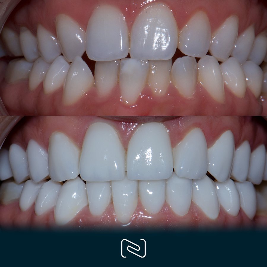 Neo Dental Cancun - Neo Dental Cancun