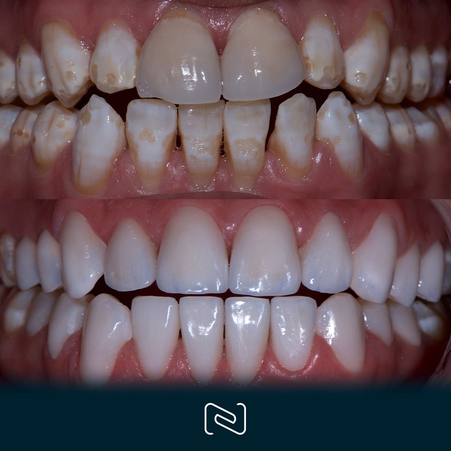 Neo Dental Cancun - Neo Dental Cancun