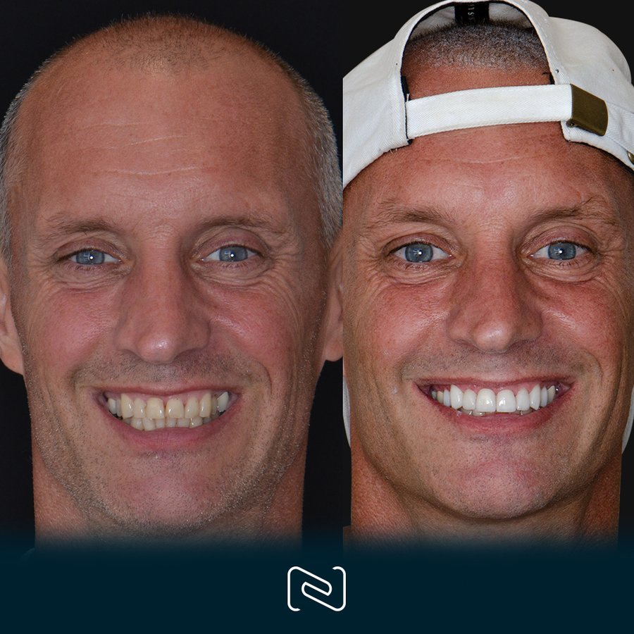 Neo Dental Cancun - Neo Dental Cancun