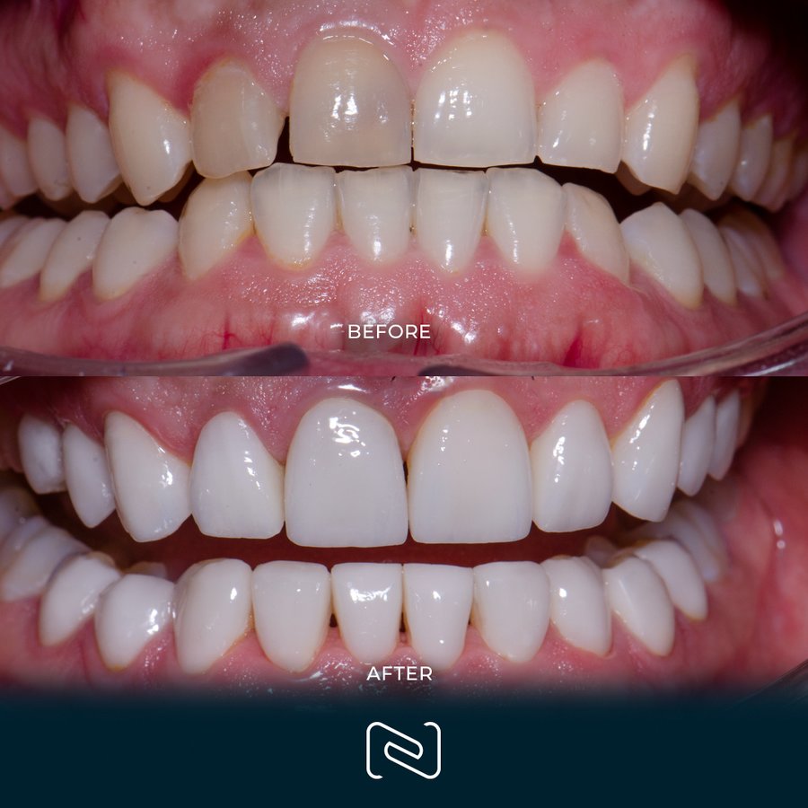 Neo Dental Cancun - Neo Dental Cancun