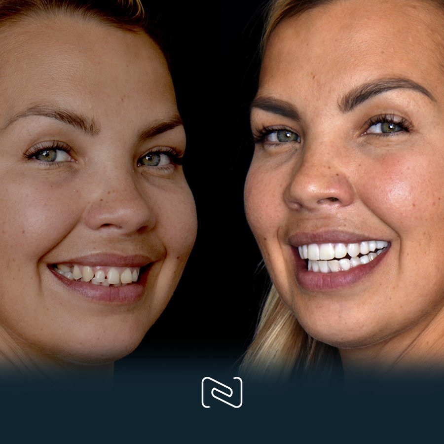 Neo Dental Cancun - Neo Dental Cancun