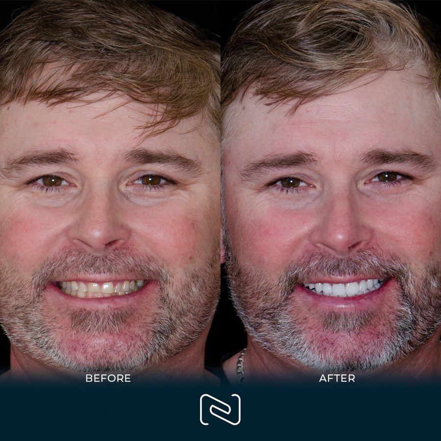 Neo Dental Cancun - Neo Dental Cancun