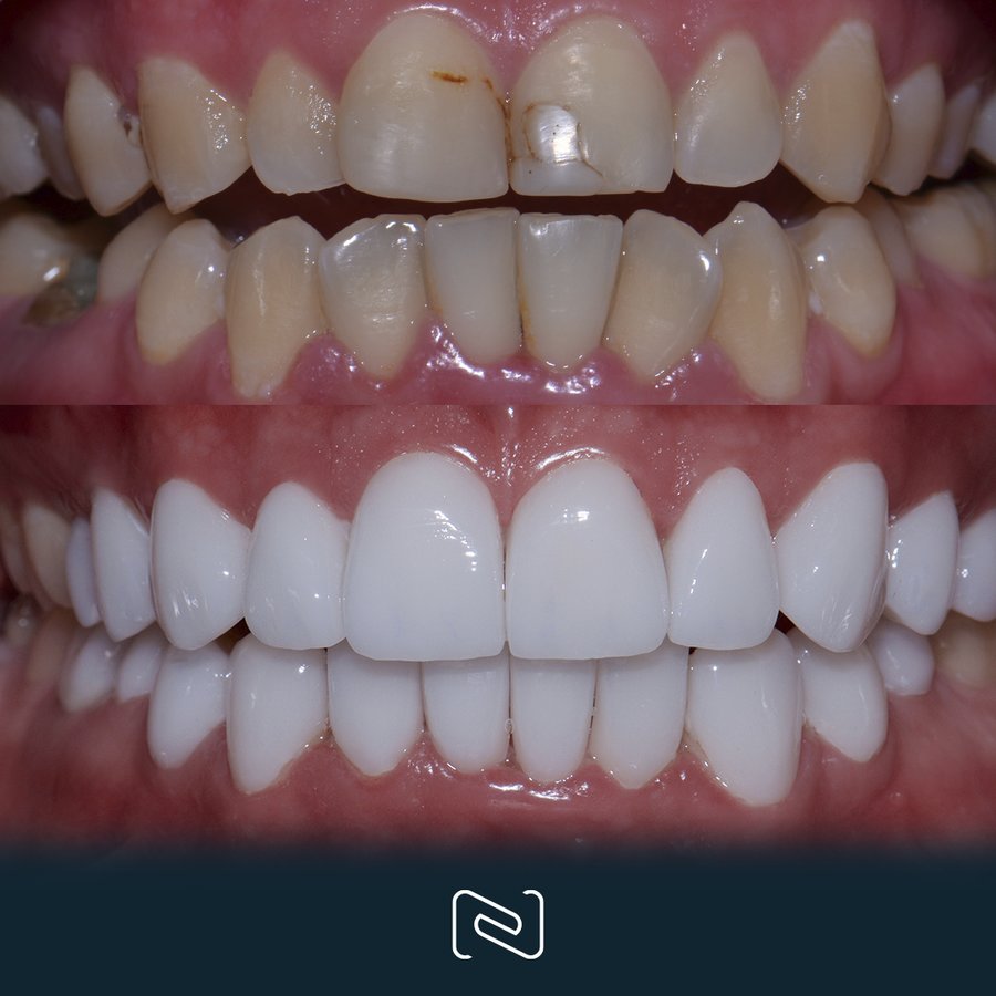 Neo Dental Cancun - Neo Dental Cancun