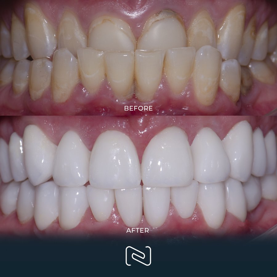 Neo Dental Cancun - Neo Dental Cancun