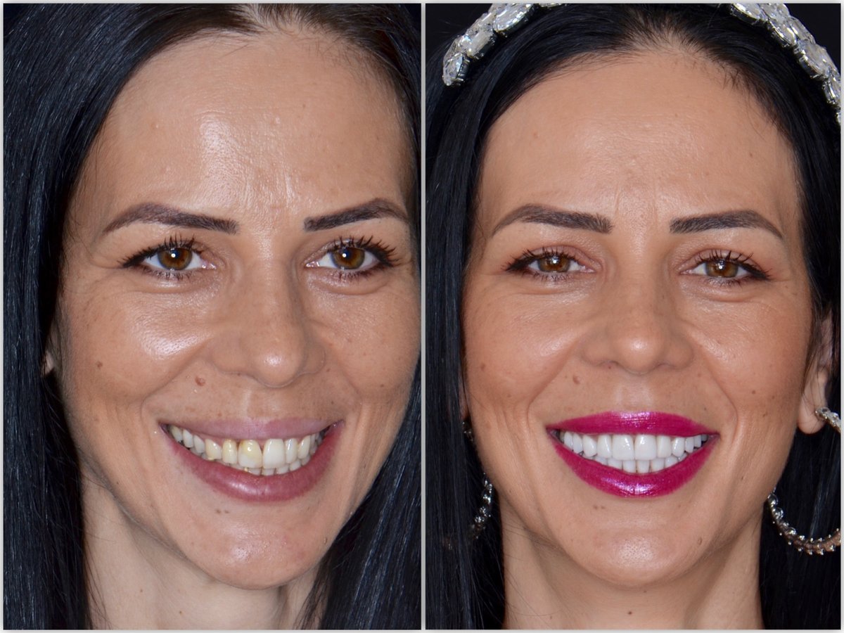 Neo Dental Cancun - Neo Dental Cancun