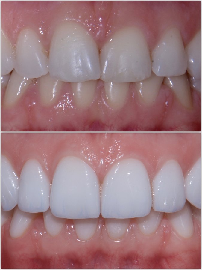 Neo Dental Cancun - Neo Dental Cancun