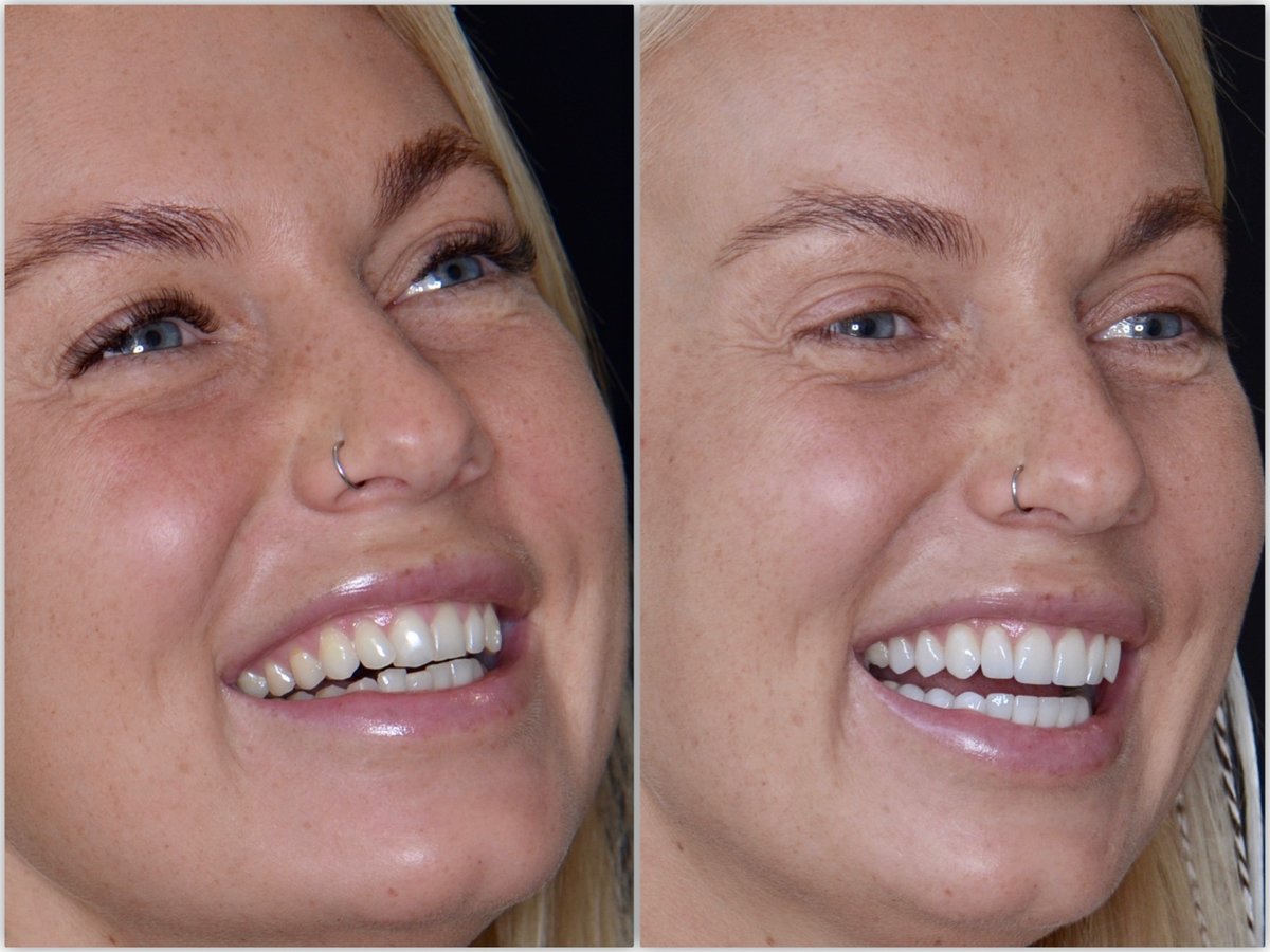 Neo Dental Cancun - Neo Dental Cancun