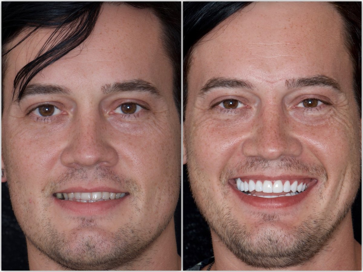 Neo Dental Cancun - Neo Dental Cancun