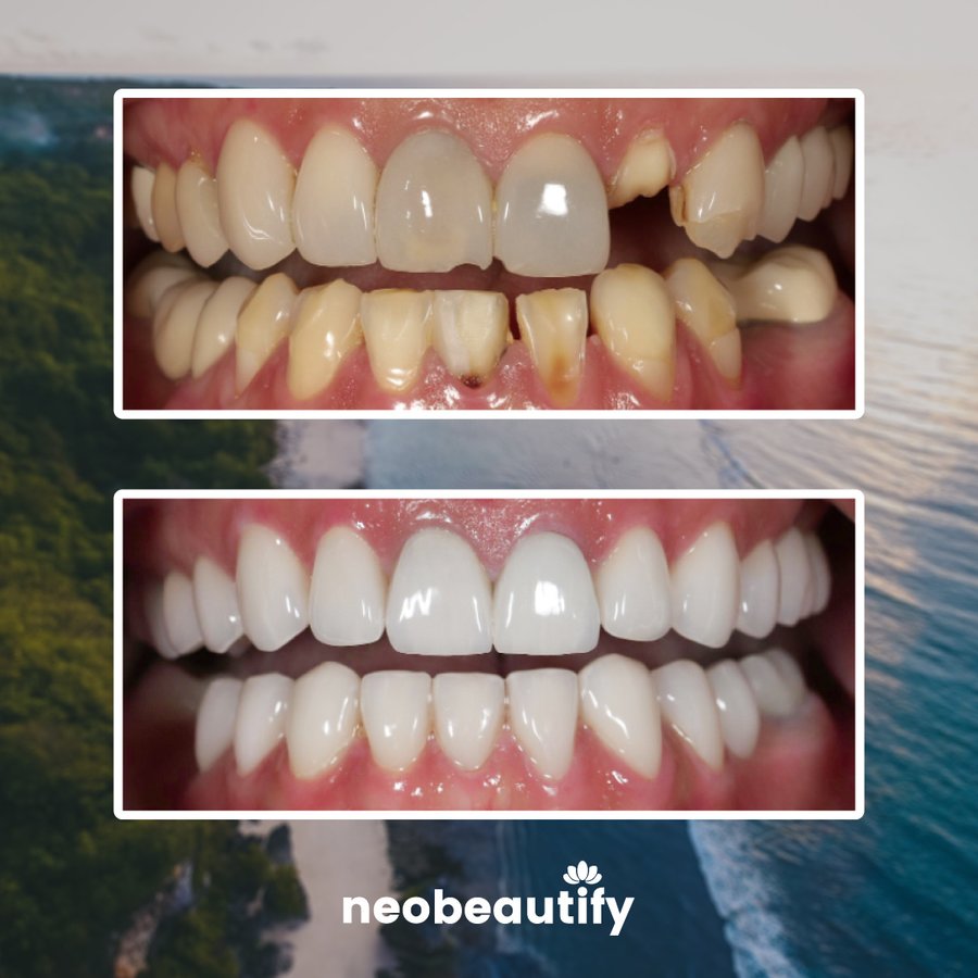 Neobeautify - Neobeautify