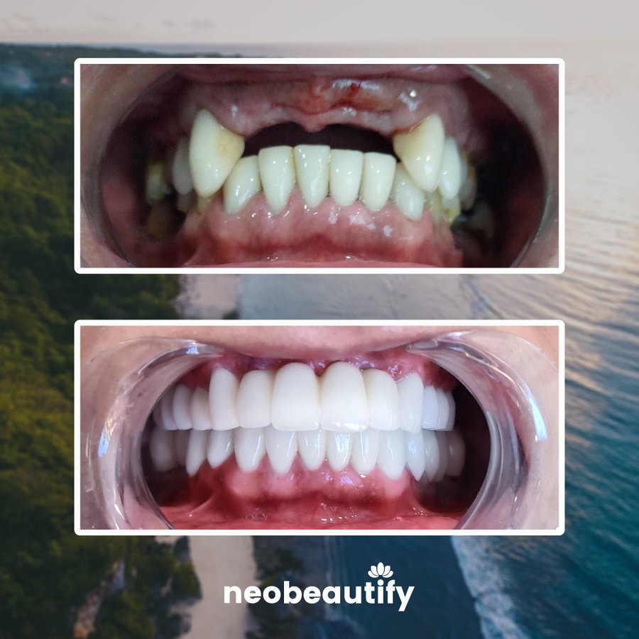 Neobeautify - Neobeautify