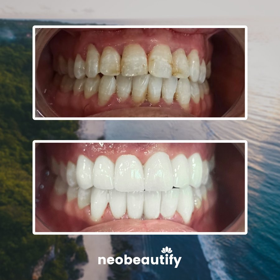 Neobeautify - Neobeautify