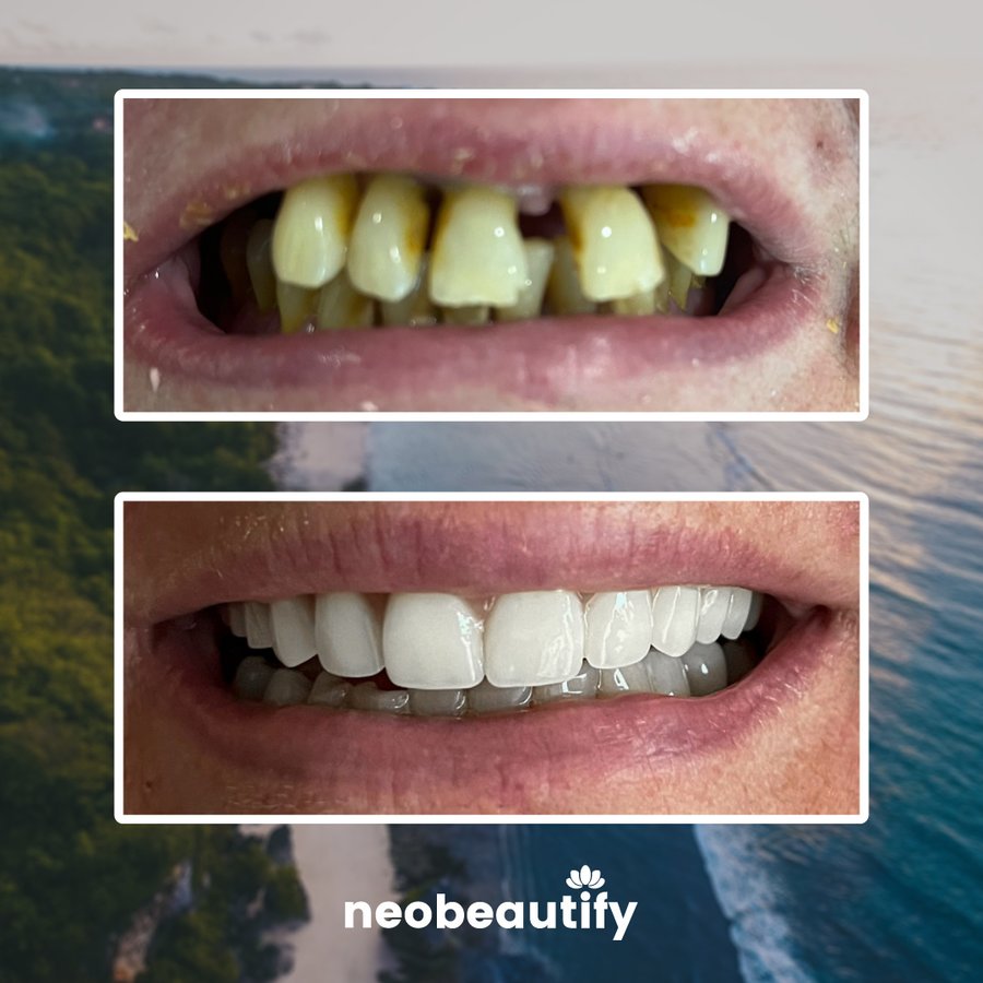 Neobeautify - Neobeautify