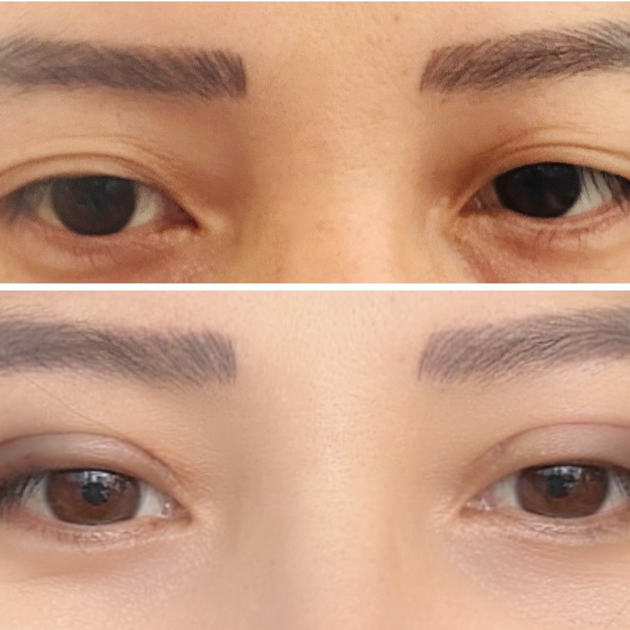 Nepal Plastic Cosmetic and Laser Center (NPCLC) - Nepal Plastic Cosmetic and Laser Center (NPCLC)