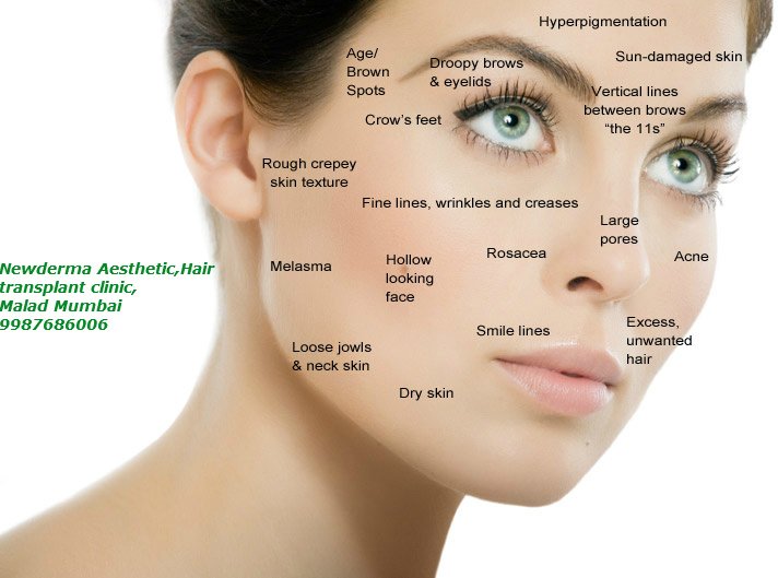 New Derma Aesthetic Clinic - Mira Road Branch - New Derma Aesthetic Clinic - Mira Road Branch