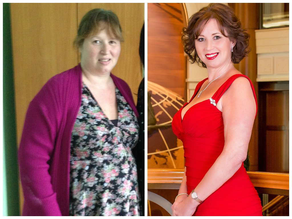 New Leaf Weight Loss Surgery Ltd - Czech Republic - New Leaf Weight Loss Surgery Ltd - Czech Republic